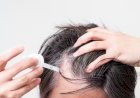 Anvisa alerta para risco de crescimento anormal de pelos em bebês expostos ao minoxidil