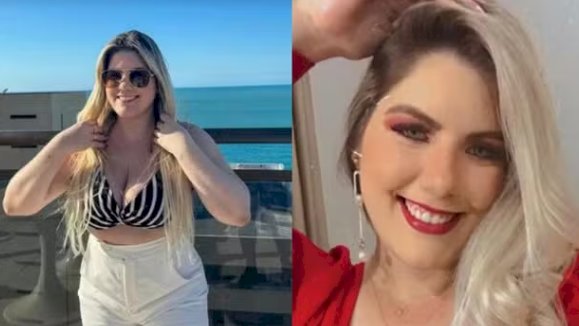 Jovem de 24 anos Morre Após Seis Cirurgias Plásticas Realizadas Simultaneamente no Ceará